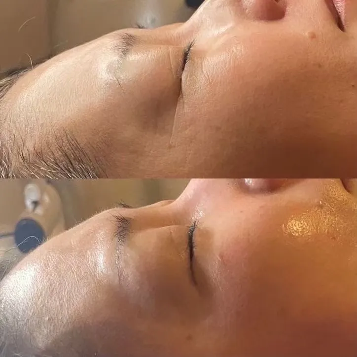 SHINEの水光ジェット効果