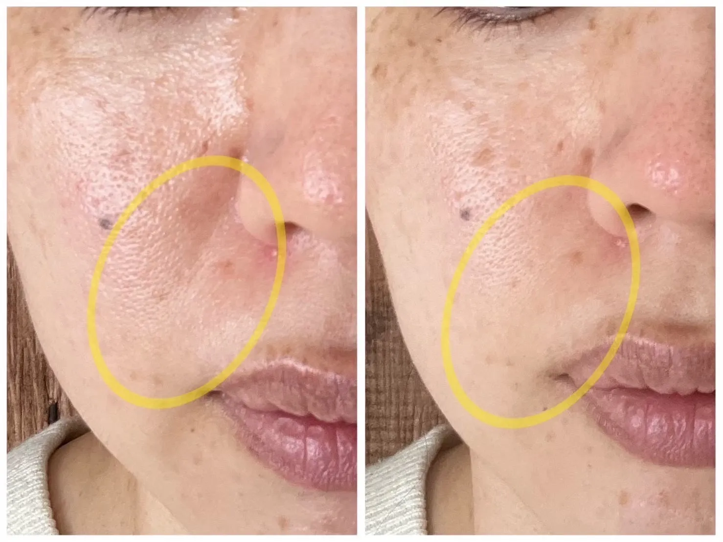 肌のお疲れサインでていませんか？